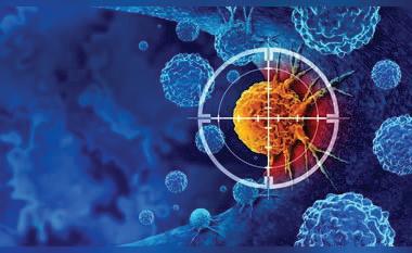 Chest infections see rise due to lesser-known bacteria