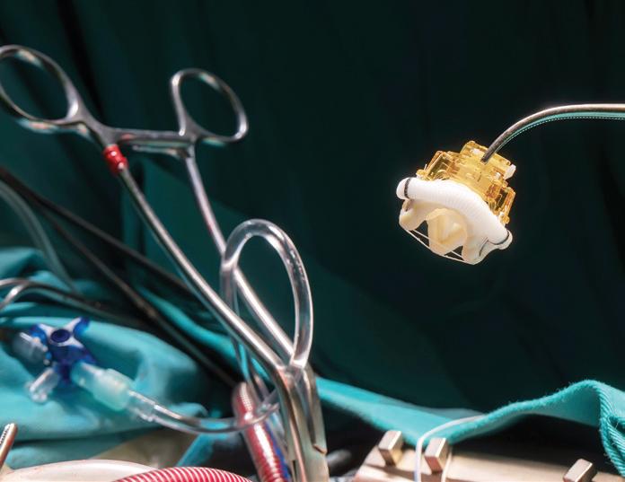 Technological advancements in minimally invasive heart procedures