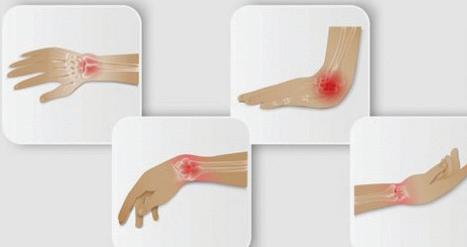 Managing Joint Pain: Effective Treatments and Practical Prevention Strategies