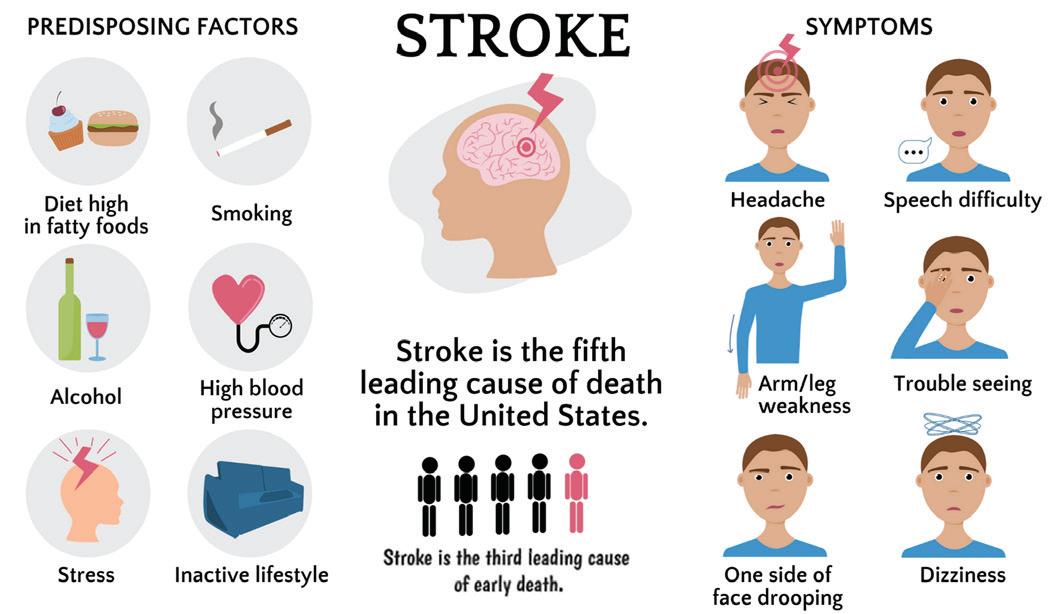 Rising stroke cases among young Indians need for AI-enabled screening
