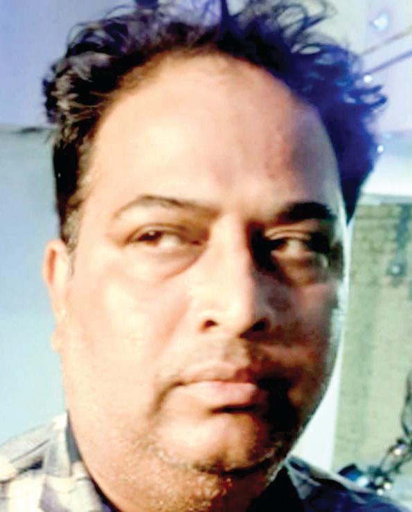 Father arrested for conspiracy in 'staged' acid attack on his daughter