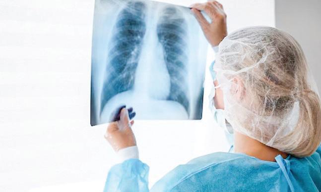 TB incidence in India drops by 21% since 2015, says WHO report