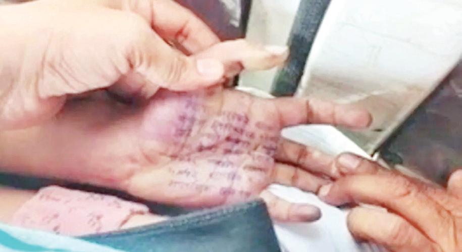 महिला डॉक्टर ने हथेली पर सुसाइड नोट लिखकर की आत्महत्या, दो पुलिसकर्मियों पर दुष्कर्म का आरोप