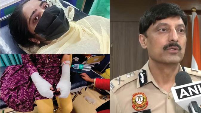 एक तीर से कई शिकार करने के लिए रची एसिड अटैक की कहानी