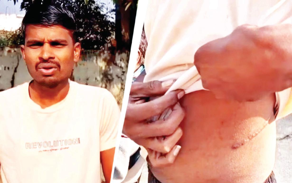 कर्ज चुकाने के लिए किसान ने कंबोडिया जाकर बेची अपनी किडनी