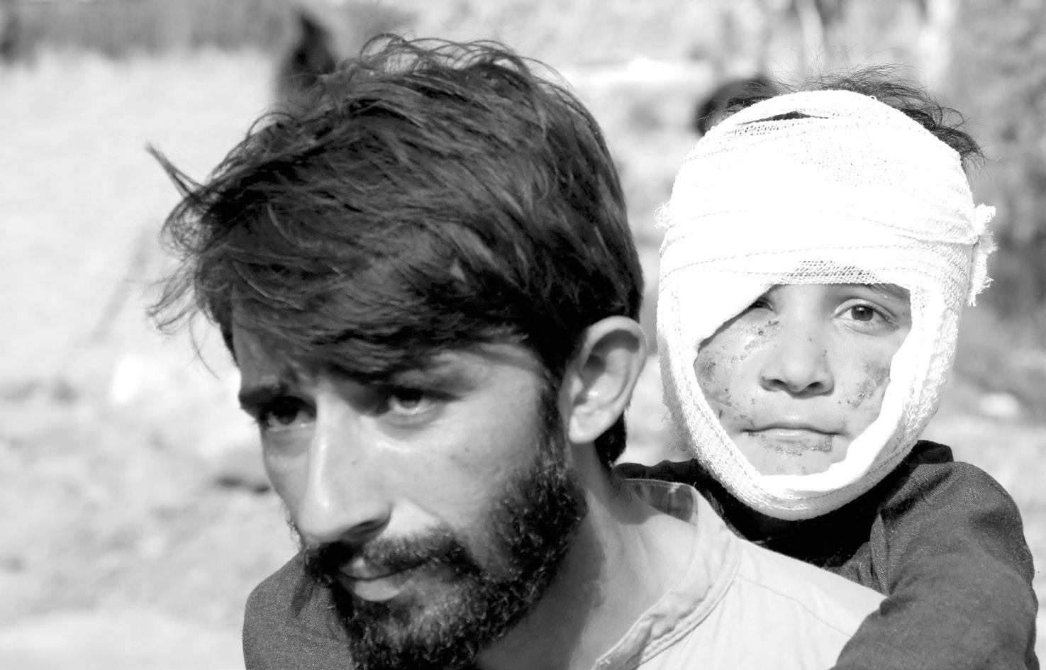 Powerful aftershocks cause more injuries