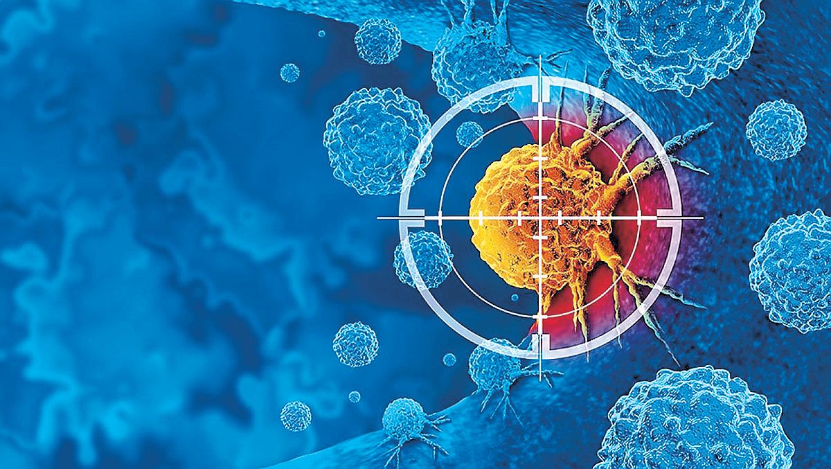 What Filipinos Need to Know About Head and Neck Cancer