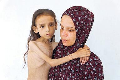 Gaza father grieving loss of child scrambles to save siblings