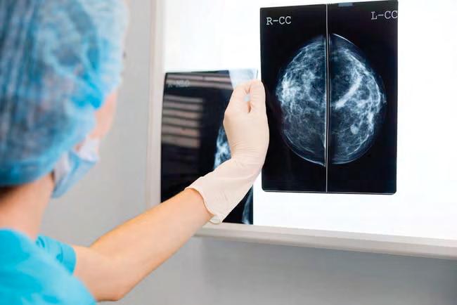 ‘Landmark’ AI trial seeks to detect breast cancer earlier