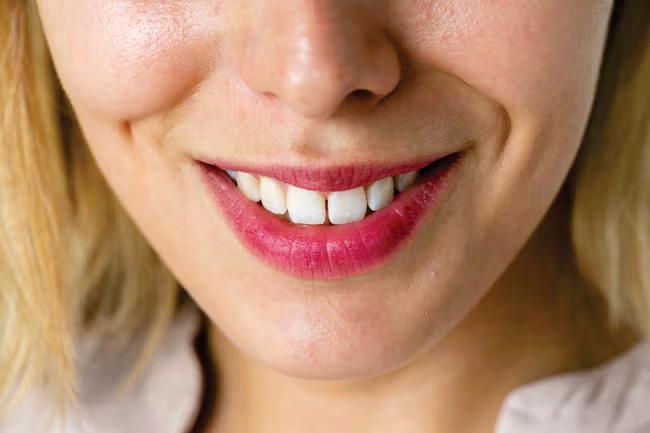 Forget Ozempic face the real worry is Ozempic teeth