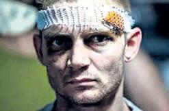 Wounded Ukrainian soldiers ask: What ceasefire?