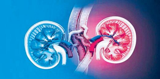 Blood type mismatch key factor for kidney transplants