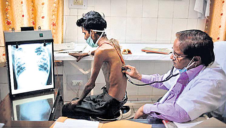 TN first state to implement TB death prediction model