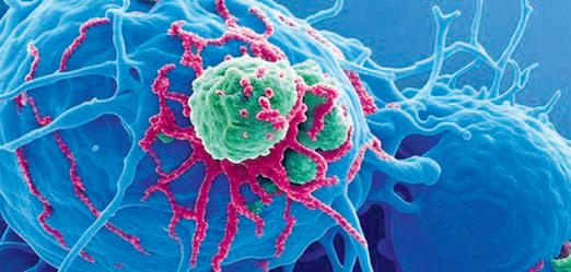 GI cancers rising among middle-aged adults