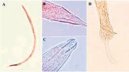 Berhampur University researchers discover new round worm species