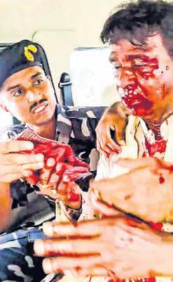 BJP MP bleeds after mob attack in Bengal
