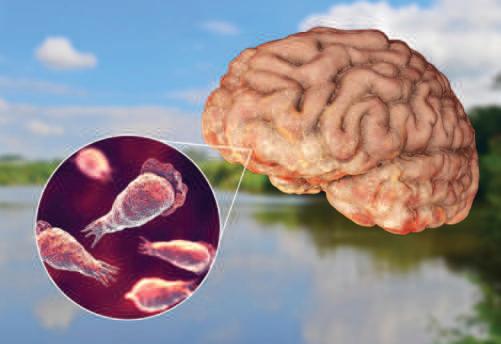 Rare But Ruthless: How A Deadly Amoeba Is Claiming Lives In Kerala