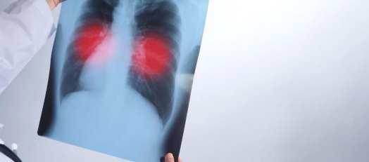 PGIMER Flags Rise in Rare Chest Infections in North India