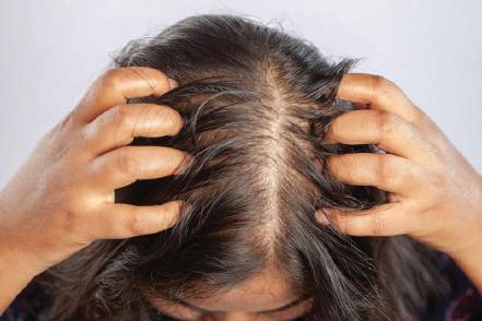 Analysis Suggests Common Hair Loss Drug Consumption By Mothers May Pose Risks To Infants
