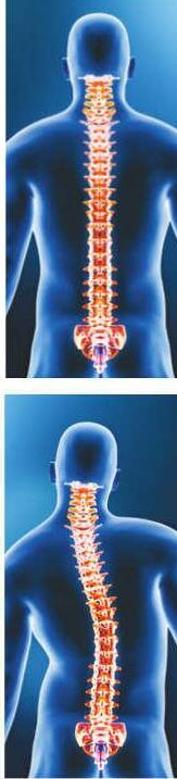 Initiative to treat spinal deformities