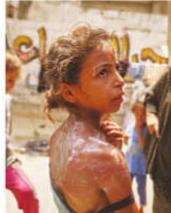 36 Palestinians Killed for Trying to Obtain Desperately Needed Aid in Gaza