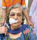 एयरपोर्ट पर वृद्धा को नहीं दी व्हीलचेयर, गिरने से हुई जख्मी, आइसीयू में भर्ती