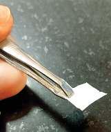 दांत में दबा पैच करेगा दर्द और सूजन का इलाज