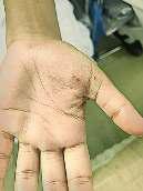 स्कूल में घुस आया बंदर, नौ छात्राओं को काटा