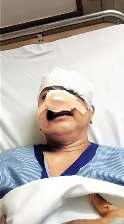 कुत्ते ने पांच फीट ऊंची छलांग लगाकर नाक नोची, हुई सर्जरी