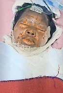 हापुड़ में पड़ोसी ने महिला पर डीजल छिड़ककर लगा दी आग