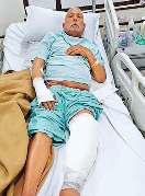 कार सवार युवकों की असंवेदनशीलता, बुजुर्ग को टक्कर मारकर किया घायल