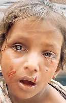 अलीपुर में चार वर्षीय बच्चे पर कुत्तों ने किया हमला