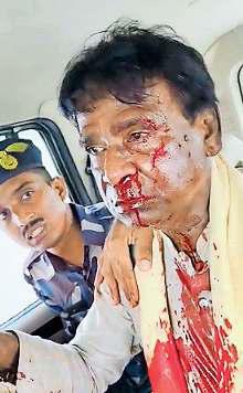 बंगाल में भाजपा सांसद व विधायक पर हमला, घायल