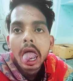 अंडा करी बनाने से ना कहा तो पत्नी ने काटी पति की जीभ