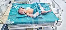 बंदर ने नवजात को मां से छीन कुएं में गिराया, सीपीआर से बची जान