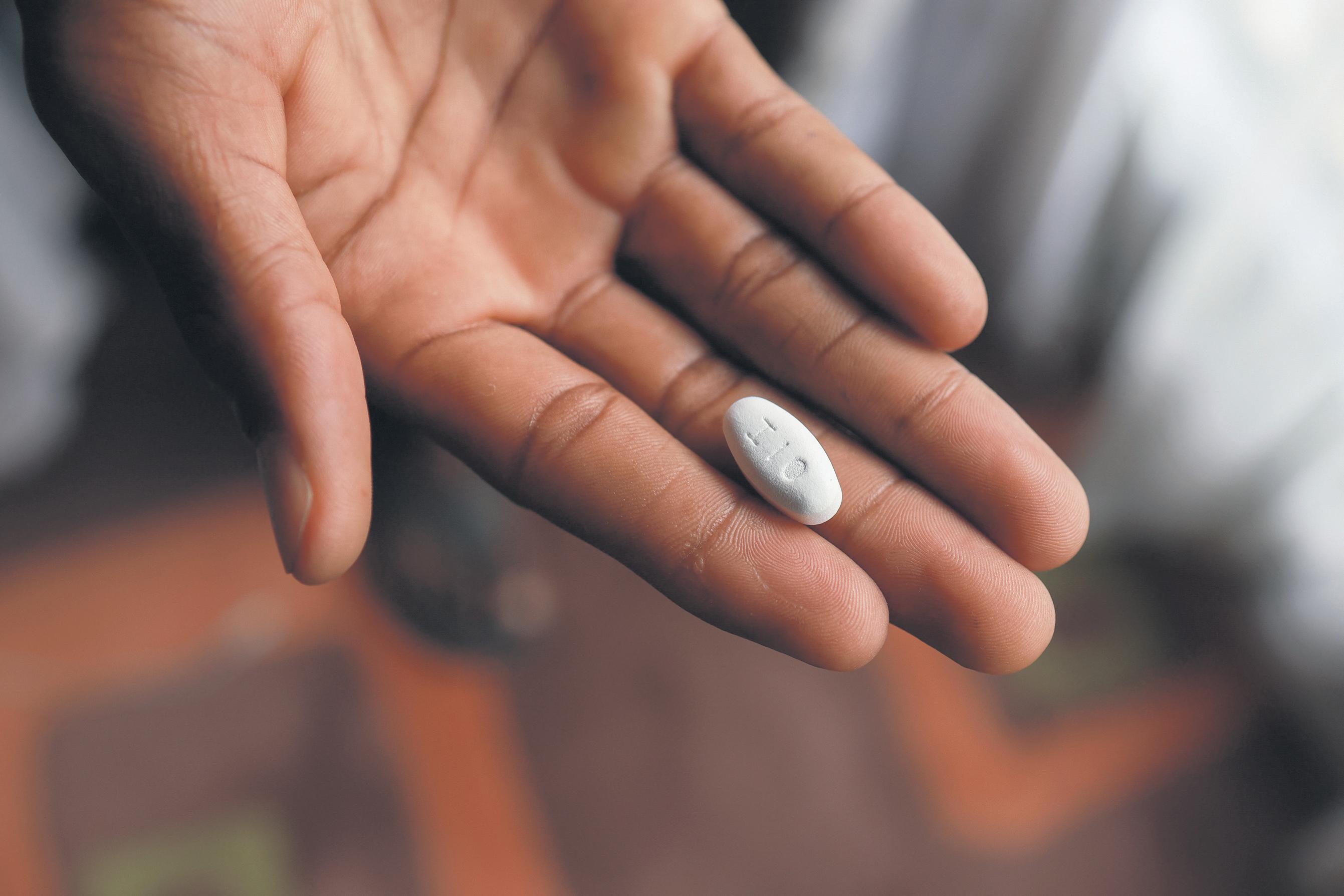 Reversing Aids gains