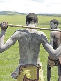 Over 20 intiates hospitalised after botched circumcisions