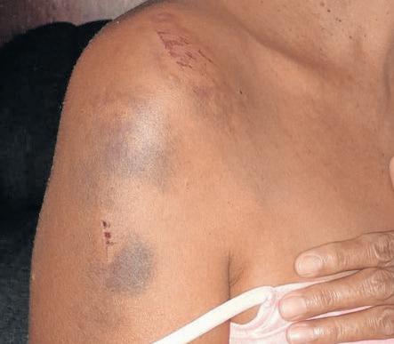 Cape Town woman survives R300 attempted hijacking attack