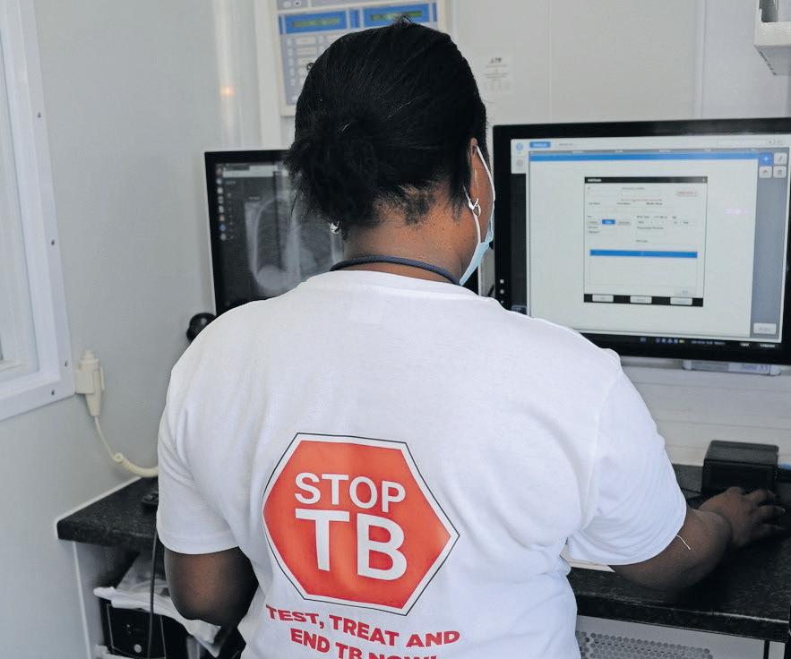 TB is still South Africa’s biggest killer, but it does not have to be