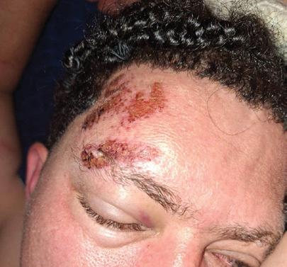 IPID investigates alleged police assault