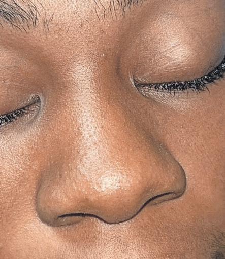 NEW #NONOSEJOB TREND ON TIKTOK EMBRACES UNFILTERED BEAUTY