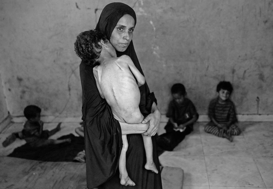 Severe famine in Gaza will worsen our hunger pandemic