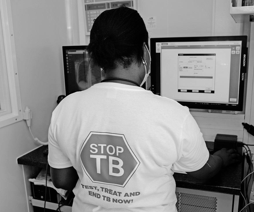 TB is still South Africa’s biggest killer, but it does not have to be