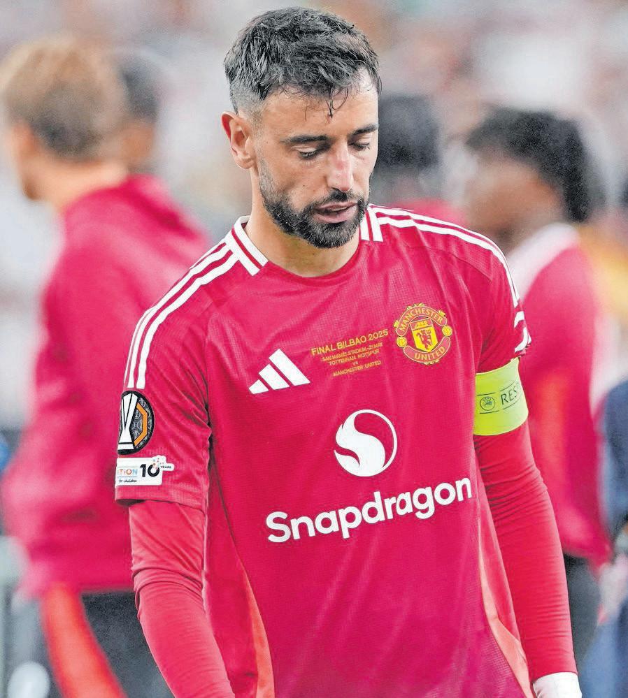 Amorim fears Fernandes out 'a while'
