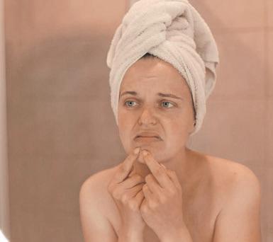 Still breaking out? The grown-up’s guide to navigating hormonal acne