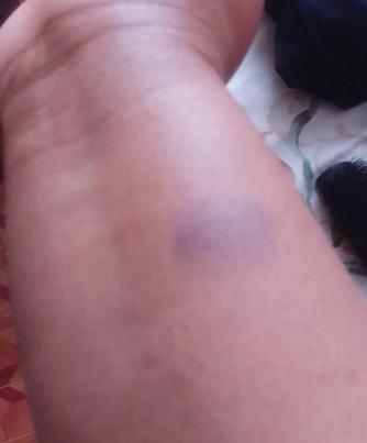 'HE TRIED TO HIT ME WITH A HEATER'
