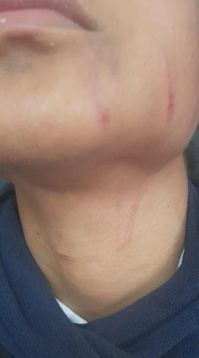 School bullying leaves scars