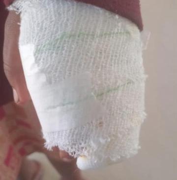 Skollies delay girl's treatment