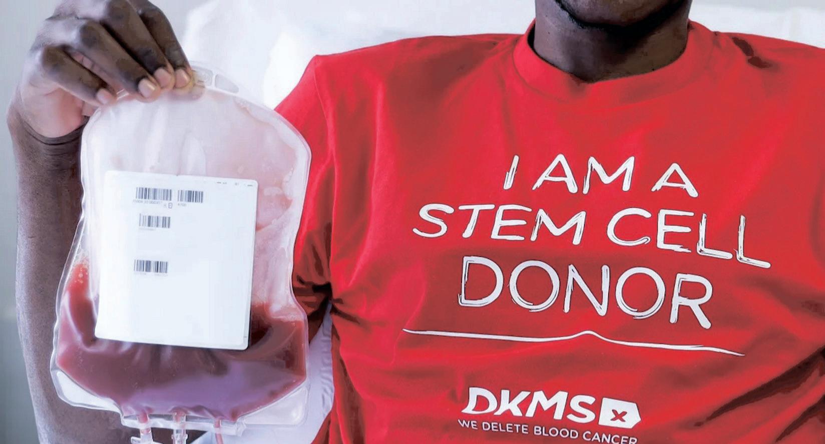 Need for stem cell transplants in SA
