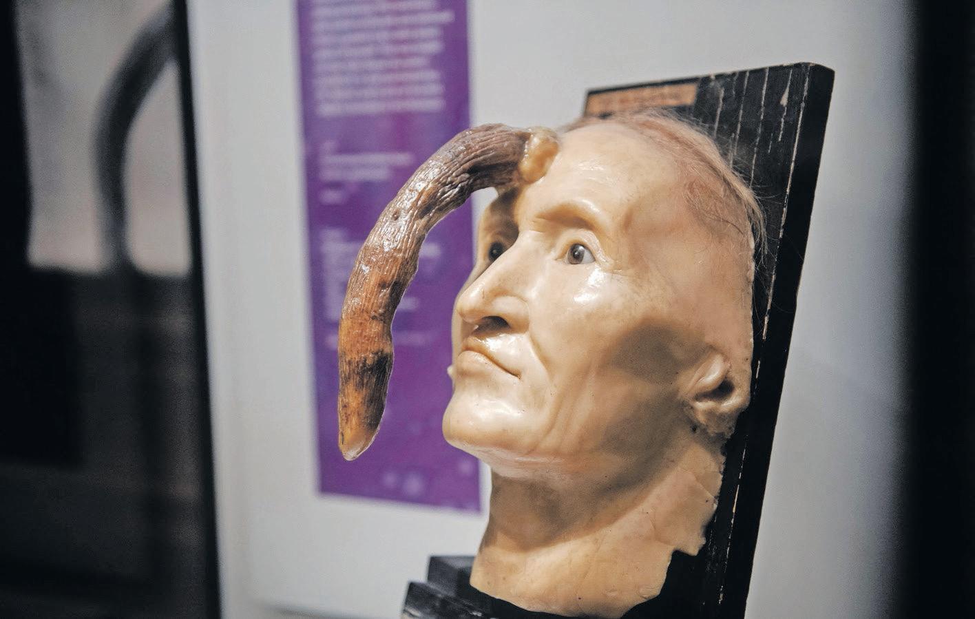 Ethics of exhibiting human remains: what museums must confront